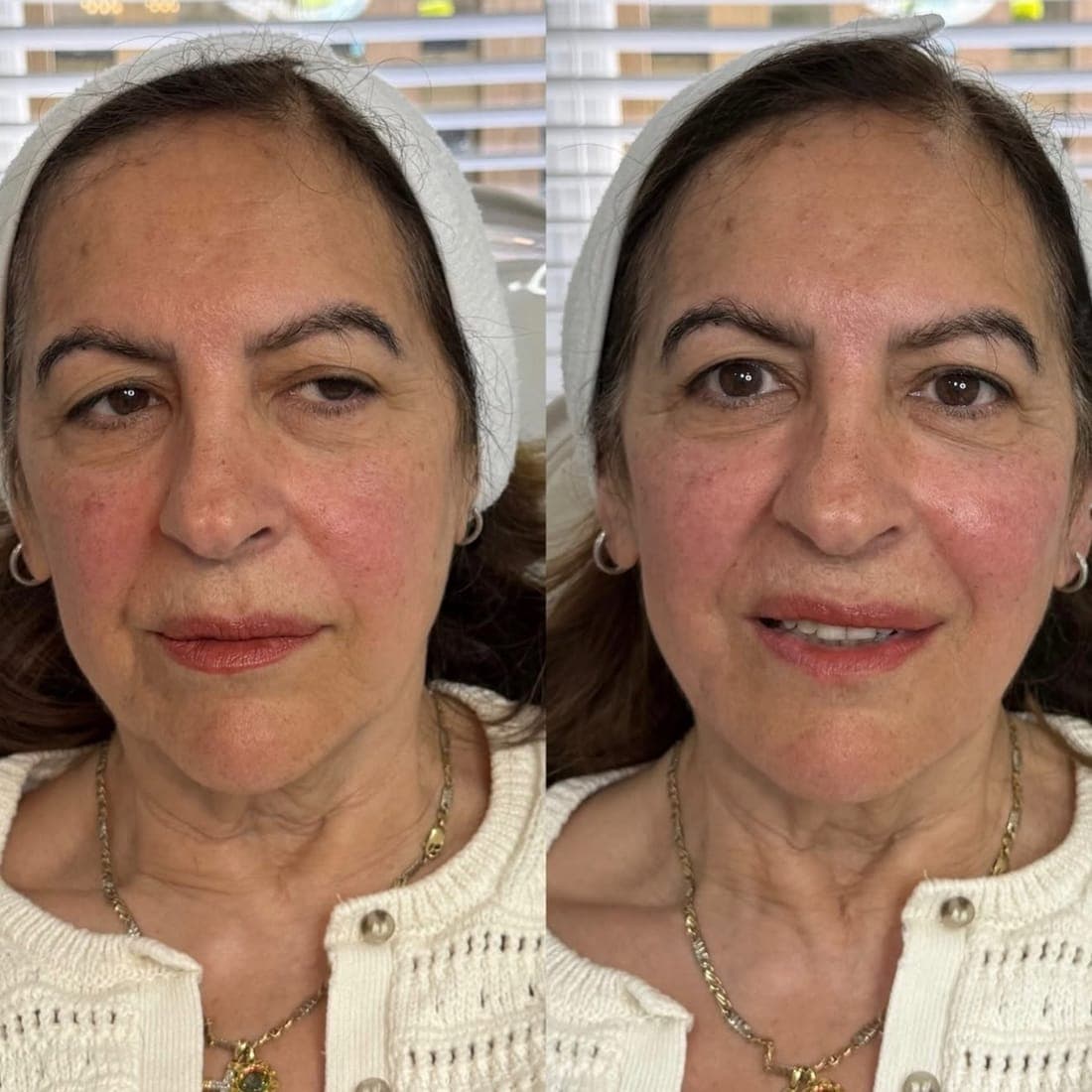 Full face before and after, side by side, cream knitted top